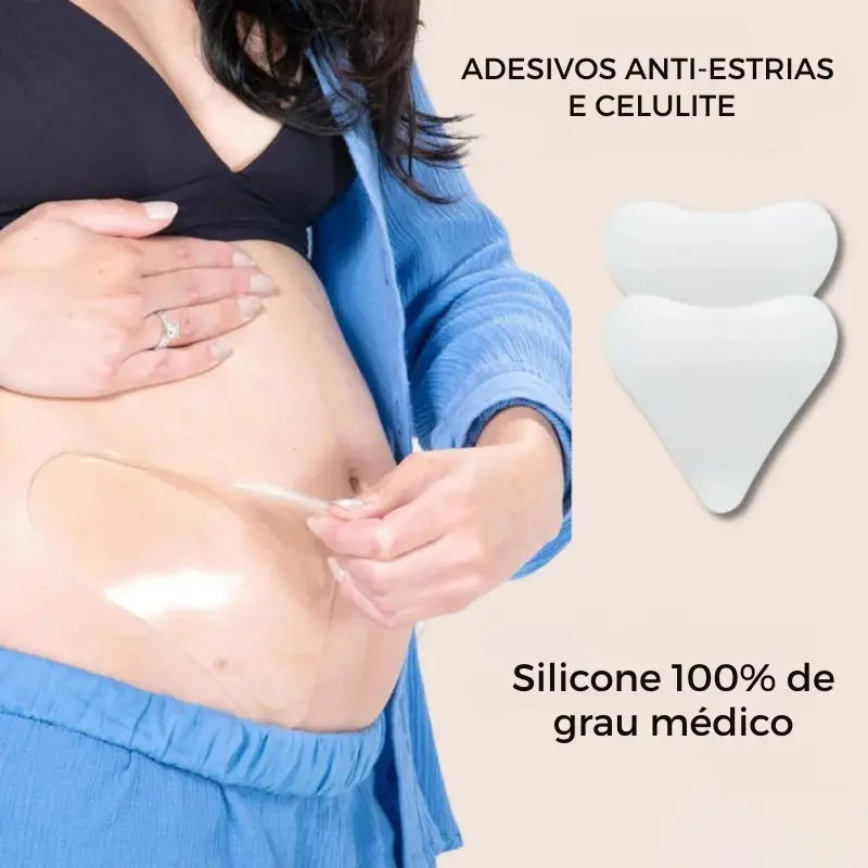 Plaquinha de oclusão 90 dias sem estrias