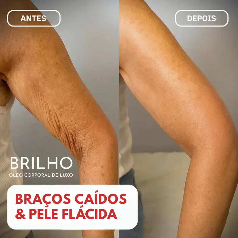 Óleo Corporal Mágico™ Beladermy - 100ml