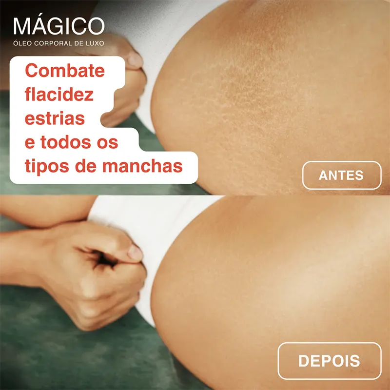 Óleo Corporal Mágico™ Beladermy - 100ml