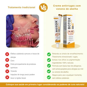 BotoxBee® | Pareça 15 anos mais jovem em apenas 3 minutos!