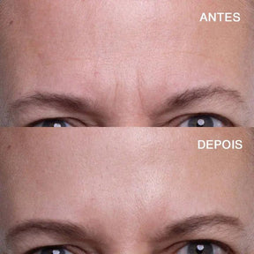 Adesivo antirrugas para testa